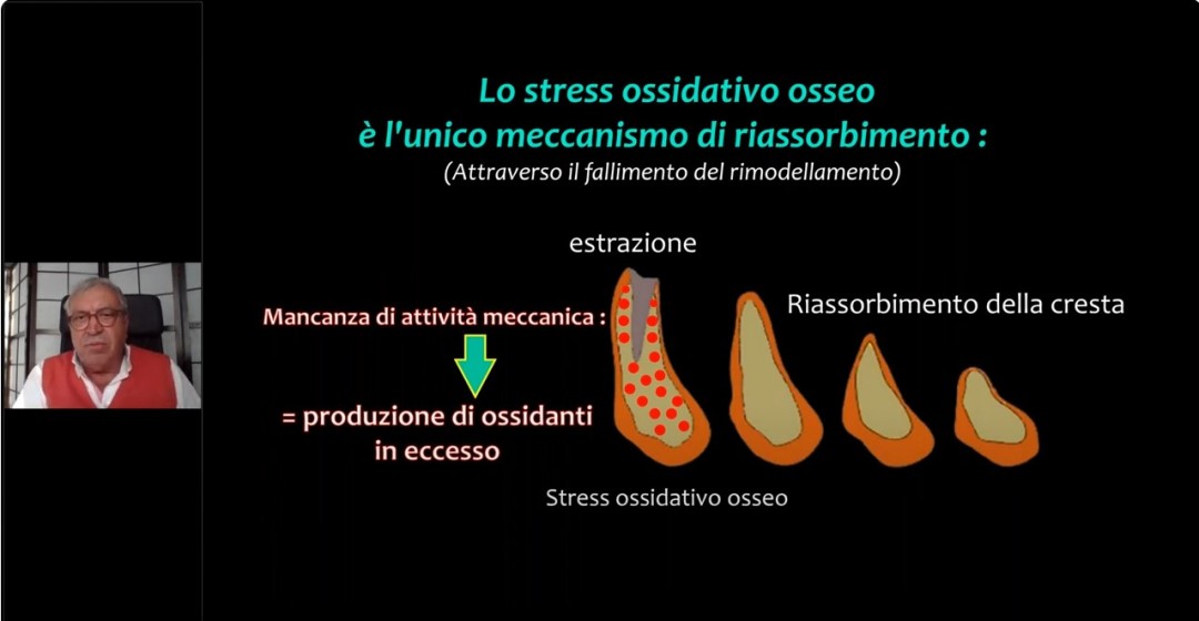 PROF JOSEPH CHOUKROUN - Osteoimmunologia la perimplantite è una malattia immunitaria... Argomenti scientifici e clinici