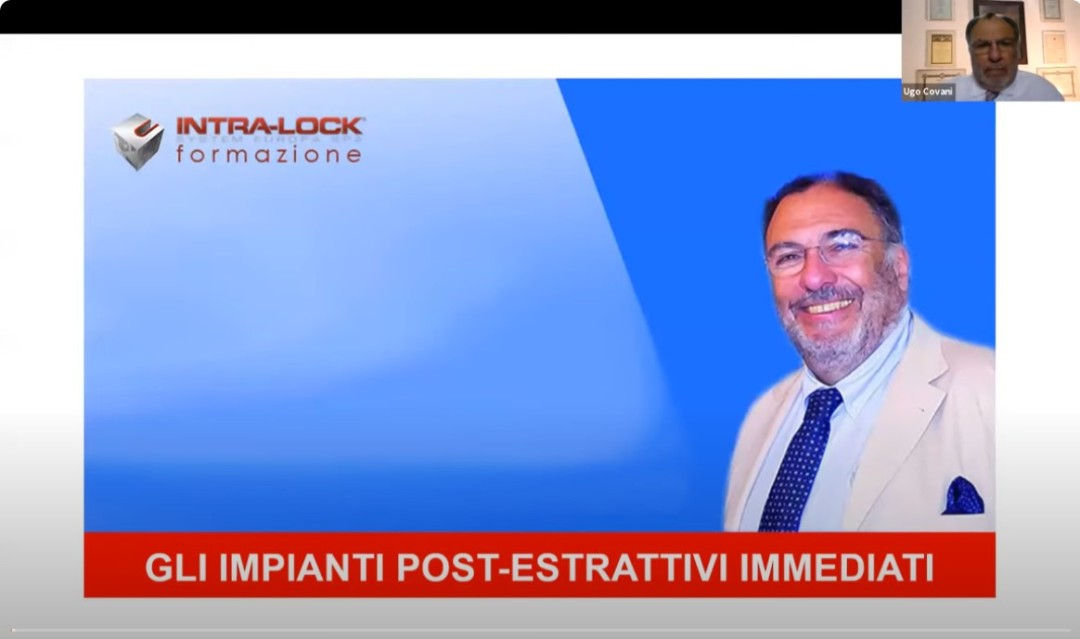 PROF UGO COVANI - DR GIUSEPPE BENINCASA - DR GENNARO FALIVENE - LEZIONE 5 - IMPIANTI POST ESTRATTIVI IMMEDIATI