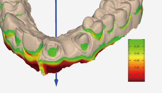 Controllo del sottosquadro